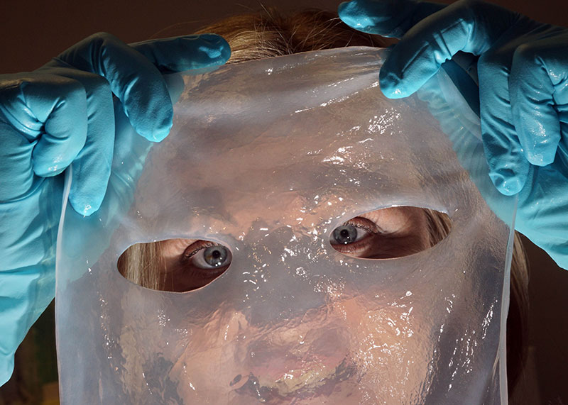 Dieses Biomaterial aus Nanozellulose war der Ausgangspunkt für eine erfolgreiche Ausgründung aus der Universität Jena. Die Chemikerinnen Dr. Dana Kralisch und Dr. Nadine Heßler (im Bild) gründeten die JeNaCell GmbH, die 2021 von Evonik aufgekauft wurde.