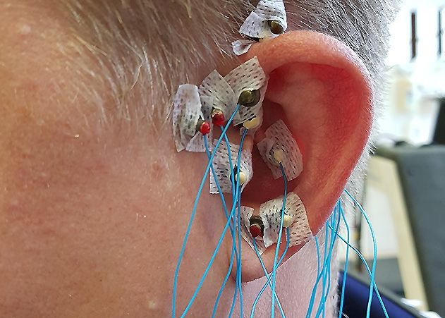 Uniklinikum Jena: Probanden für Messungen an der Ohrmuskulatur gesucht. 30 Euro bekommt man als Aufwandsentschädigung.