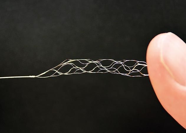 Mit einem filigranen Maschennetz lassen sich Gefäßverklumpungen bei Schlaganfällen entfernen.